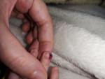 Образовался гнойник на пальце у месячного ребенка фото 2
