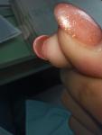 Шелушение кожи под ногтем, зуд, жжение фото 3