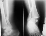 Комментарий к ренген снимку травмы ноги фото 1