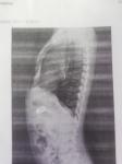 Инородное тело в желудке реьенка фото 2