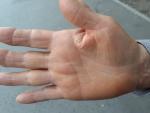 Коричневая кожа между пальцами рук фото 2