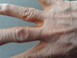Коричневая кожа между пальцами рук фото 1