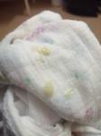 Сопли у новорожденого фото 2