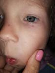 Паутинка на глазу у ребёнка 4 года фото 3