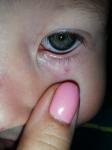 Паутинка на глазу у ребёнка 4 года фото 2