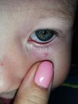 Паутинка на глазу у ребёнка 4 года фото 1