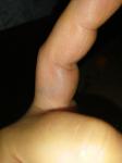 Болит палец и опух фото 2