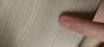 Коричневое пятно на ногте - меланома? фото 2