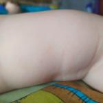 Сыпь на внутренней стороне руки у ребенка фото 5