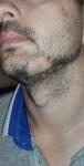 Белые пятна волос в бороде фото 1