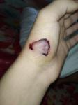 Рана от ножа фото 1