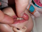 Пятна на детских зубах фото 2