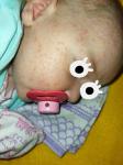 Аллергия у новорожденного 1,5 дней фото 1