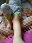 Х- образные ножки у мал 2,5 года. Нужен ли массаж фото 1