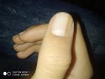 На пальце ногтя полоса фото 1