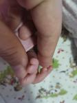 Отросточек на пальце у новорождённой фото 2