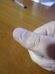 Проблема с ногтями после приема витаминов Компливит фото 1