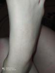 Сыпь непрнятного происхождения на ногах фото 1