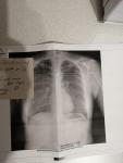 Потология лёгких по снимку фото 2