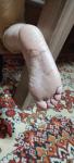 Трещины на стопах ног и чешется кожа на теле фото 1