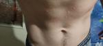 Непонятная сыпь на теле в виде аллергии пищевой на теле фото 2