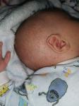 Сыпь новорожденного фото 1