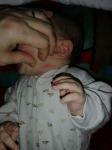 Пятно на шее у младенца фото 2