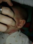 Пятно на шее у младенца фото 1