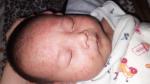 Сыпь у новорождённого ребёнка фото 2