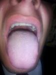 Боль в горле, белый язык фото 4