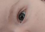 На крае глаза у младенца фото 1