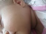 Мелкая сыпь на лице и теле у ребенка фото 5