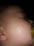 Мелкая сыпь на лице и теле у ребенка фото 2