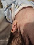 Потница или аллергия у грудничка 1,5 месяца фото 1