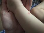 Резкая сыпь у грудного ребенка на руках. Не беспокоит фото 2