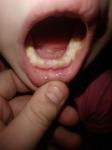Неровный зуб фото 1