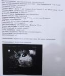 Не визуализируется жёлтое тело при беременности фото 1
