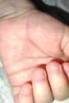 Раздражающая аллергия сыпь у ребенка фото 3