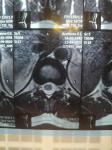 МРТ пояснично кресцового отдела с захватом грудного отдела позвоночника фото 3