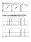 Холтеровское мониторирование, давление, ЭКГ фото 2