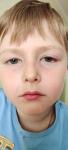 Опух глазик у ребенка фото 1