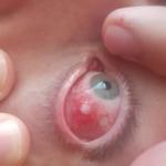 Болит глаз после травмы фото 1
