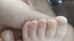 Слоятся ногти на ногах у ребенка фото 2