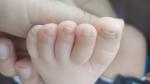 Слоятся ногти на ногах у ребенка фото 1