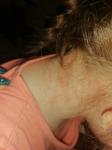 Красные пятна у ребёнка на лице, немного шершавые фото 4