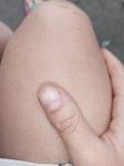 Полоска на ногте большой палец фото 3