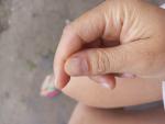 Полоска на ногте большой палец фото 1