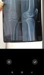 Рентген коленного сустава фото 1