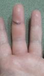 После пореза опух палец фото 1