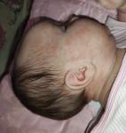Сыпь у младенца держится больше недели. Чч чтокраснеет при плаче фото 2